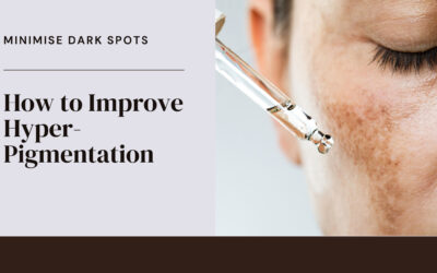 How to Improve Hyperpigmentation